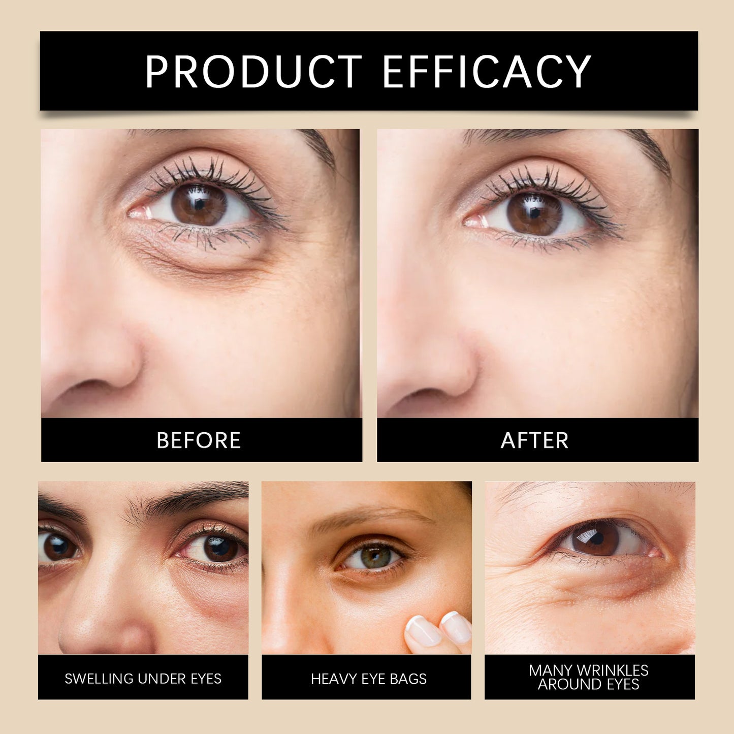 Hoygi  Retinol Eye Cream: Fade Fine Lines, Nourish, Hydrate & Daily Care